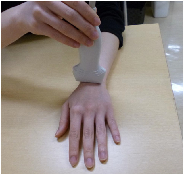 Distal Radioulnar Joint Kinematics Evaluated Using Ultrasonography During Handstanding in Female Gymnasts.