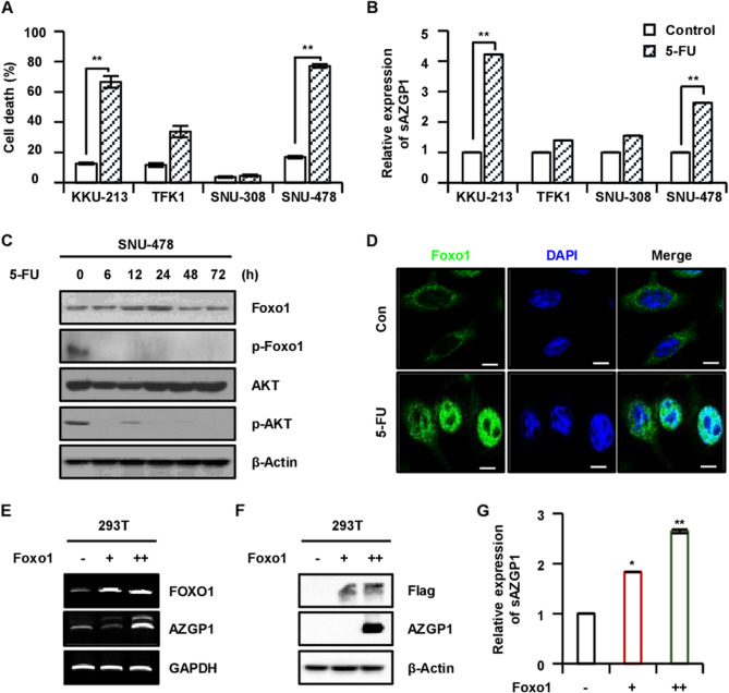 Secreted AZGP1 induced by 5-FU binds to PD-L1 and promotes apoptosis in cholangiocarcinoma.