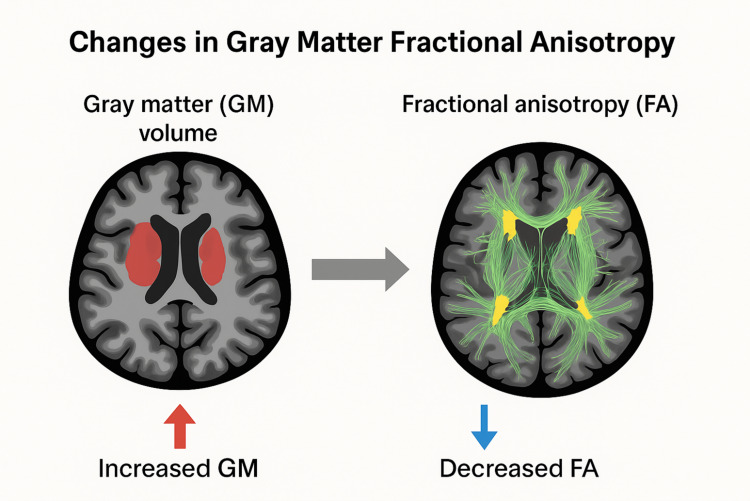 Advances in Neuroimaging of Breast Cancer Pain: An Overview.