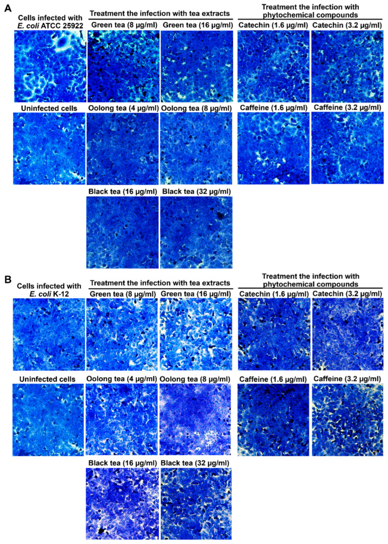Antimicrobial and Cytoprotective Effects of Tea Extracts Against <i>Escherichia coli</i>-Producing Colibactin Toxin Infections.