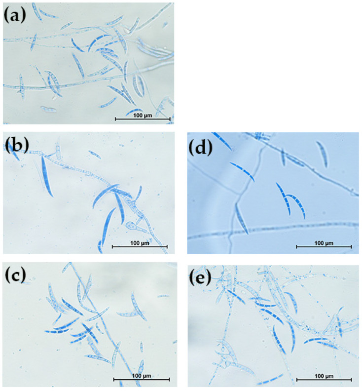 In Vitro Antifungal Activity of Amphotericin B-Encapsulated Silk Fibroin-Chitosan Nanoparticles Against <i>Fusarium solani</i> Isolates from Keratitis Patients.