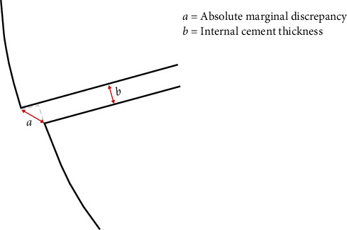 Effect of a Modified Preparation Design on the Marginal and Internal Fit of 3D-Printed Onlays: A Feasibility Study.