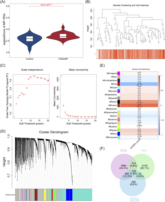 Discovering biomarkers for chronic sinusitis with nasal polyps: a study integrating bioinformatics analysis and experimental validation of macrophage polarization and metabolism-related genes.