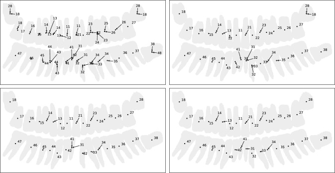 Determination of Kennedy's classification in panoramic X-rays by automated tooth labeling.