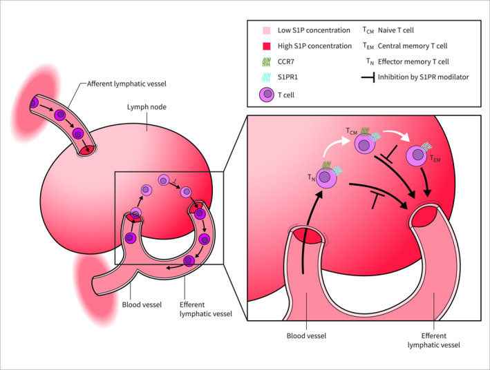 Sphingosine-1-Phosphate Receptor Modulators for the Treatment of Ulcerative Colitis: A Narrative Review Focusing on Safety.