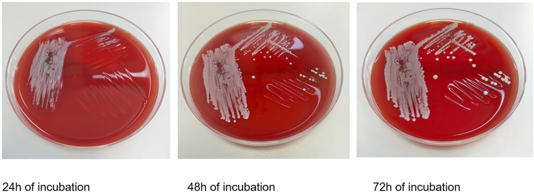 Relevance in question: A rare case of Actinomyces radicidentis bacteremia.