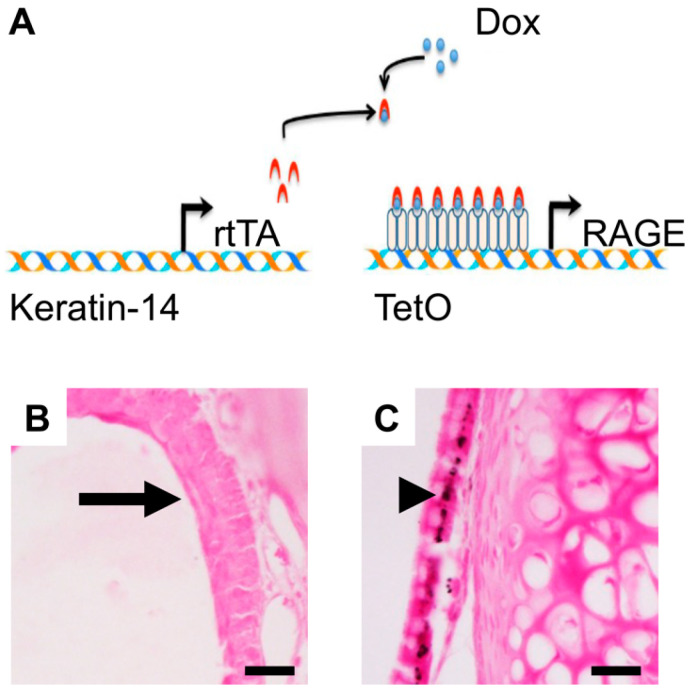 Inflammatory Molecule Elaboration in Secondhand Smoke (SHS)-Induced or Conditional RAGE Transgenic Modeling of Chronic Rhinosinusitis (CRS).