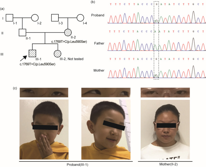 Correction: Functional characterization of SOX5 variant causing Lamb-Shaffer syndrome and literature review of variants in the SOX5 gene.