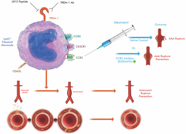 Targeting monocyte heterogeneity in aortic aneurysms: immunomodulatory strategies and therapeutic opportunities.