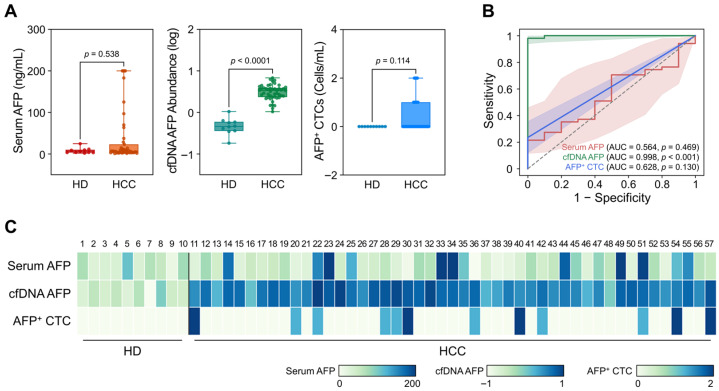 Cell-Free DNA Versus Circulating Tumor Cells: A Pilot Study of Alpha-Fetoprotein Analysis for Diagnosis and Treatment Monitoring in Hepatocellular Carcinoma.