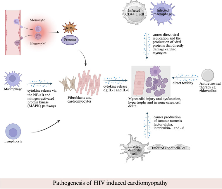 The hidden link between HIV and cardiomyopathy: unraveling HIV's impact on the heart.