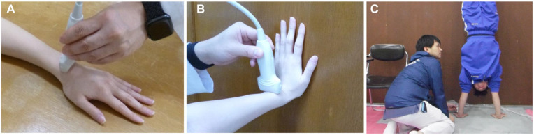 Distal Radioulnar Joint Kinematics Evaluated Using Ultrasonography During Handstanding in Female Gymnasts.