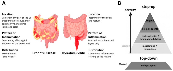 Risk for COVID-19 Vulnerability in Patients with Inflammatory Bowel Disease: Assessing Alterations in ACE2 and TMPRSS2.