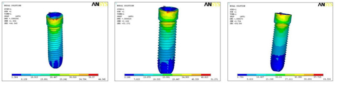 Biomechanical Analysis of Stress Distribution and Force Dynamics in Nobel Active Implants at Varying Angulations: A Finite Element Study.