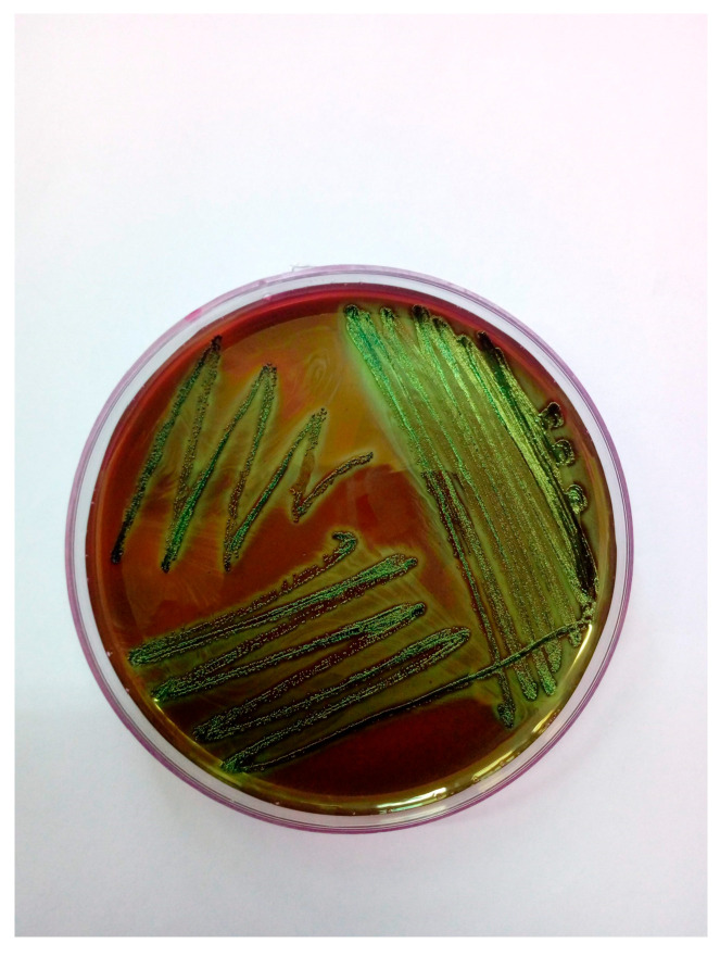 Multidrug-Resistant <i>Escherichia coli</i> Associated with Respiratory and Systemic Infection in a Domestic Rabbit in Romania: First Confirmed Case.