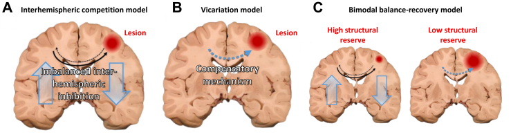 Promoting motor recovery after stroke using cortico-cortical paired associative stimulation.