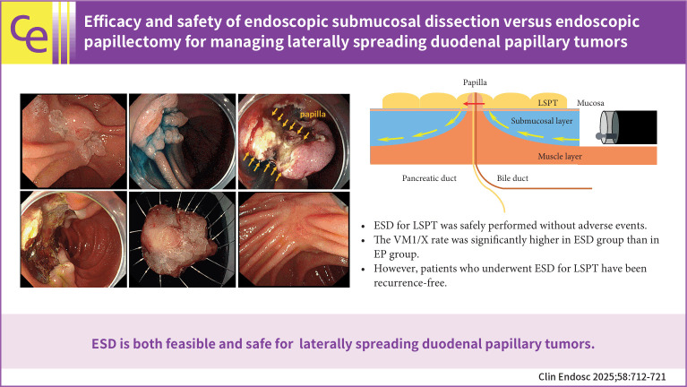 Efficacy and safety of endoscopic submucosal dissection versus endoscopic papillectomy for managing laterally spreading duodenal papillary tumors.