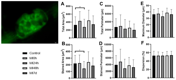 Structural Proteins at Neuromuscular Junction Are Downgraded While NRG1 and Agrin Gene Expression Increases After Muscle Injury.