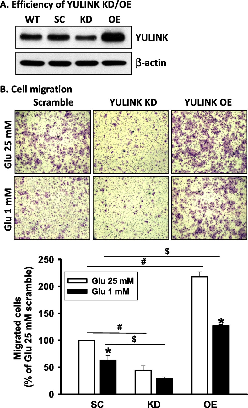 YULINK deficiency promotes cell death under glucose restriction in HCC cells in association with GLUT1-mediated glycolysis.
