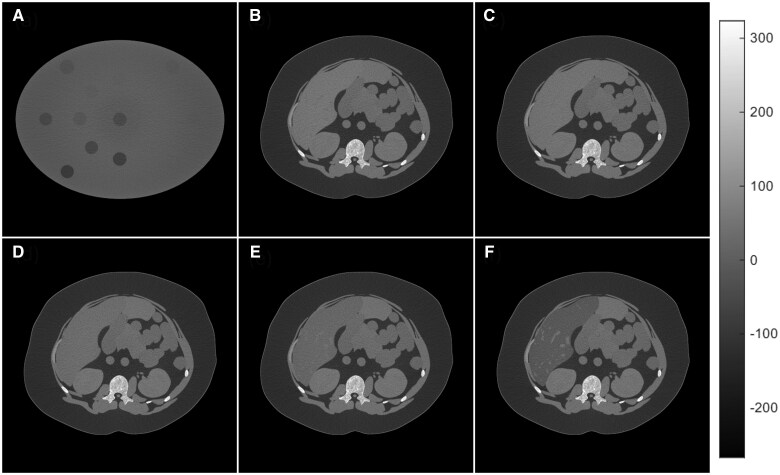 Liver fat quantification using deep silicon photon-counting CT: an <i>in silico</i> imaging study.