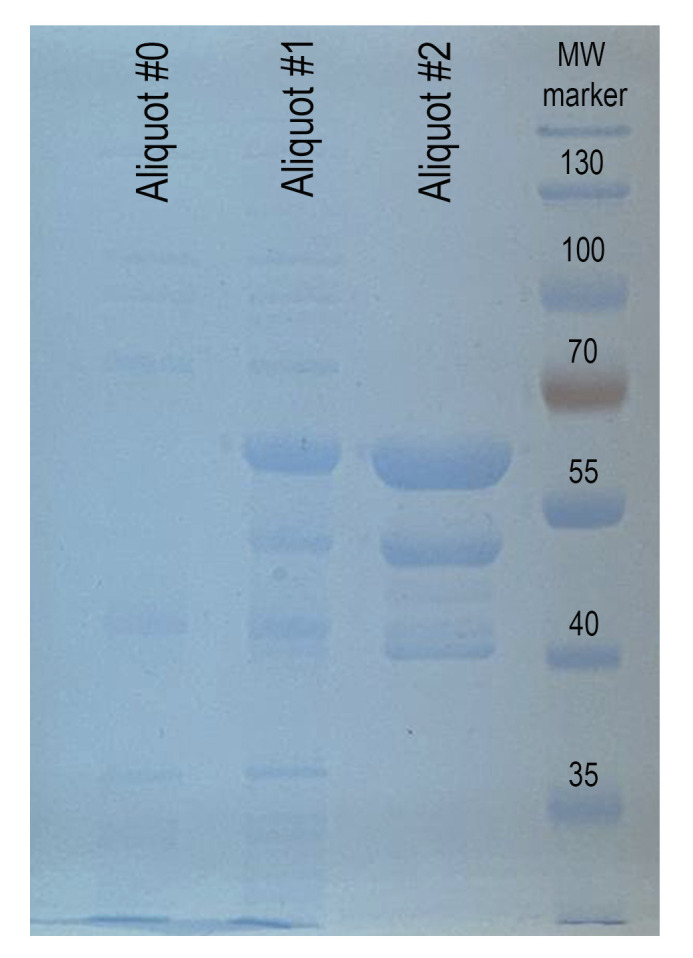 Protocol for the Preparation of a Recombinant Treacle Fragment for Liquid-Liquid Phase Separation (LLPS) Assays.