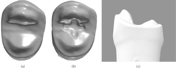 Effect of a Modified Preparation Design on the Marginal and Internal Fit of 3D-Printed Onlays: A Feasibility Study.
