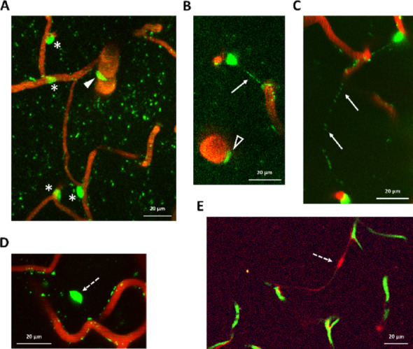 Eppur si muove: the dynamic brain pericyte.