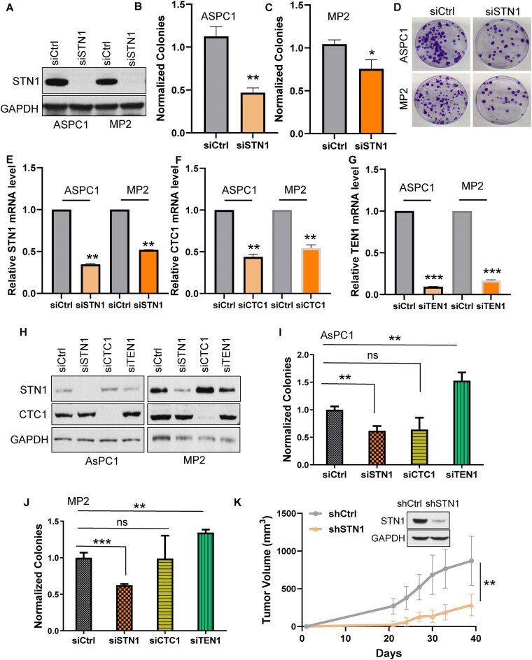 KRAS-induced STN1 (OBFC1) promotes proper CTC1-STN1-TEN1 complex-independent DNA double-strand break repair and cell cycle checkpoint maintenance in pancreatic cancer.