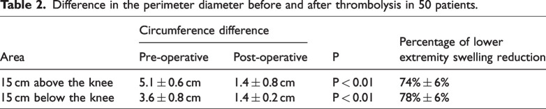Stepwise cannulation of the small saphenous vein for thrombolysis: A technique to optimize clot removal and reduce the severity of post-thrombotic syndrome.