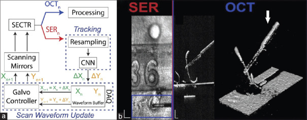 Intraoperative optical coherence tomography in ophthalmology: Technologies and applications.