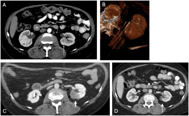 The growing armamentarium of image-guided tumor ablation in interventional oncology.