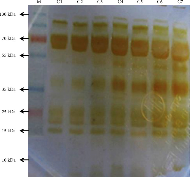 Biochemical and Biological Profiles of Bangladeshi Russell's Viper Snake Venom and Neutralizing Efficacy by Indian VINS Polyvalent Antivenom.