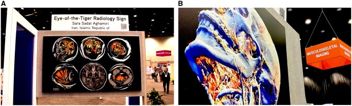 Art of imaging: intersection of aesthetics and analysis in radiology.