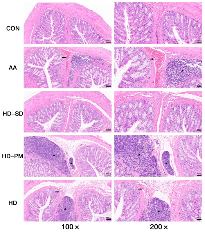 Solid Dispersion of Hesperidin Alleviates Acetic Acid-Induced Colitis Through Modulating the Gut Microbiota Dysbiosis in Rats.