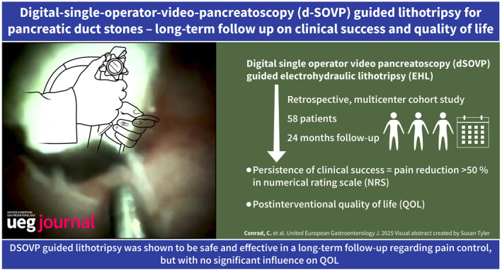 Long-Term Efficacy and Safety of Digital-Single-Operator-Video-Pancreatoscopy Guided Lithotripsy for Pancreatic Duct Stones.