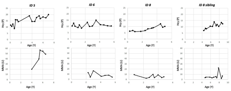 Milder Form of Cobalamin C Disease May Be Missed by Newborn Screening: The Importance of Methylmalonic Acid Assessment.