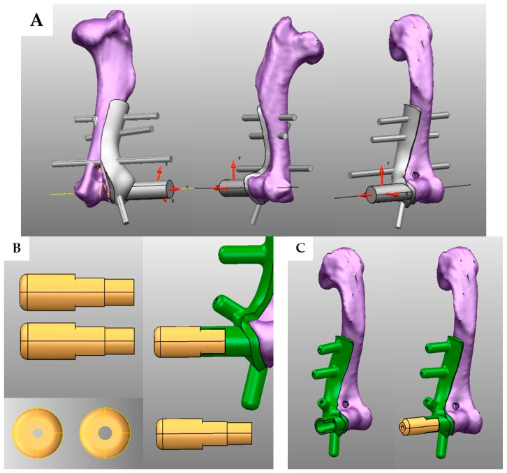 Effectiveness of Custom-Designed 3D-Printed Drill Guides in the Treatment of Lateral Humeral Condylar Fractures in a French Bulldog Bone Model.