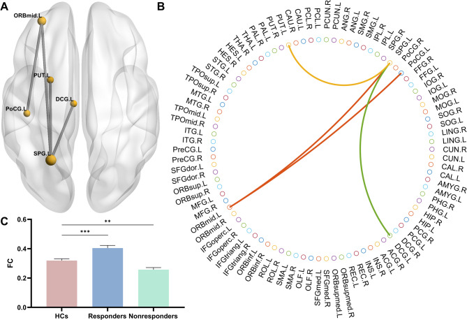 Large-scale neural network correlates of response inhibition associated with antidepressant response in major depressive disorder.