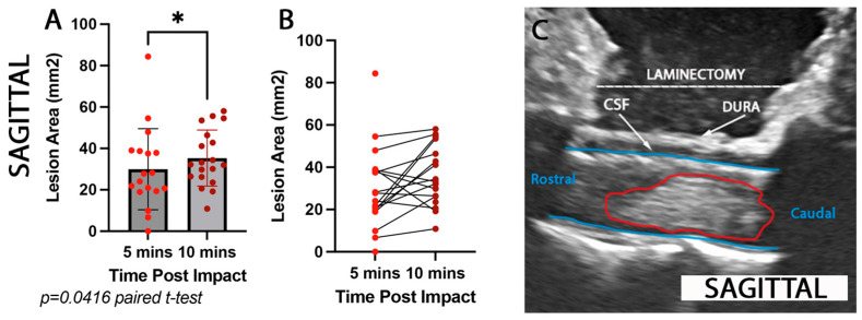 Spinal Cord Injury in Real Time: Intra-Operative Ultrasound for Acute Phase Examination in Non-Human Primates.