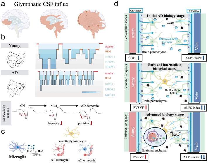 Targeting the glymphatic system: Aβ accumulation and phototherapy strategies across different stages of Alzheimer's disease.