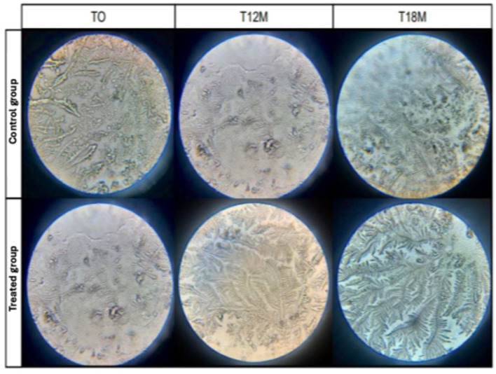 Effects of Canthoplasty in Preventing Secondary Ocular Surface Lesions in Brachycephalic Dogs.
