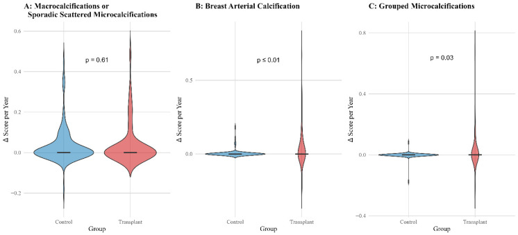 Mammographic Calcifications in Lung Transplant Recipients: Prevalence and Evolution.