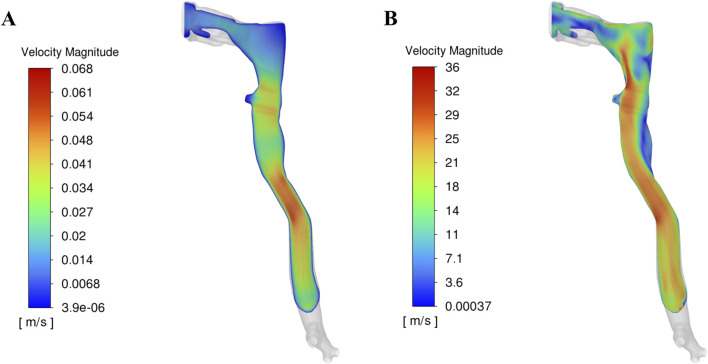 Computational modeling of cough-induced droplets and mucosal film dynamics in the upper airway for pulmonary disease classification.
