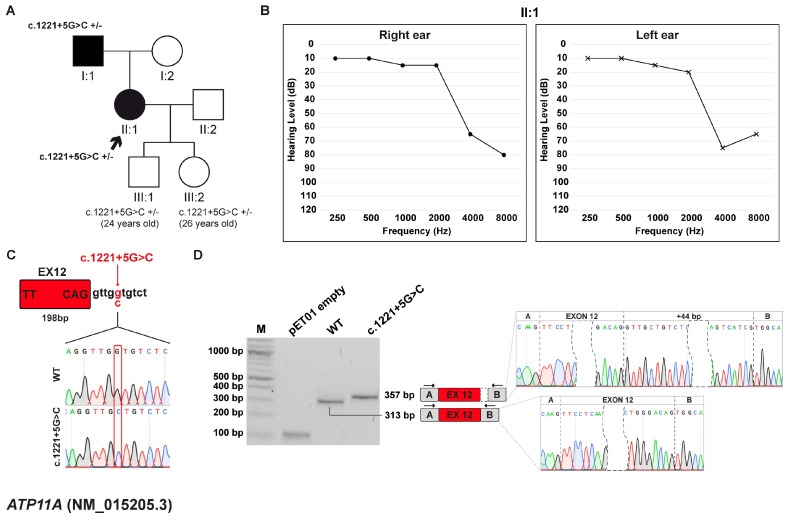 Unraveling the Functional Impact of Splicing Variants in Inherited Hearing Disorders Through Minigene Splicing Assays.