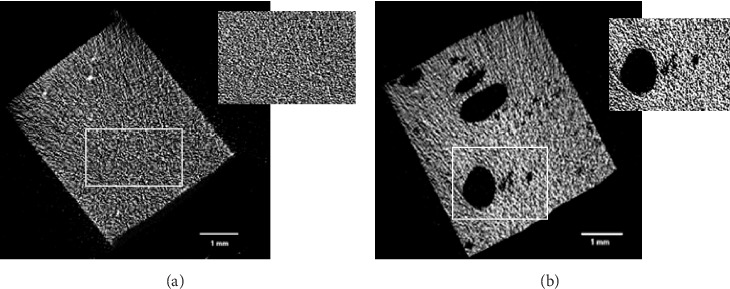 Quantitative Analysis of Closed Porosity in Direct Resin Composites: A Micro-CT Study on the Influence of Material Type.