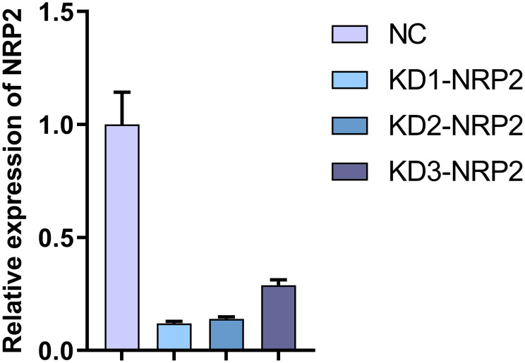 Neuropilin-2 Mediates Radioresistance in Nasopharyngeal Carcinoma via Wnt/β-Catenin Pathway.
