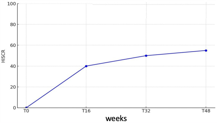 Guselkumab In A Subset Of Multifailure Patients With Hidradenitis Suppurativa: Real-Word Evidence from Federico II.