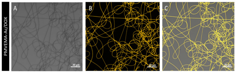 Electrospun PMVEMA Nanofibers Developed as a Fast-Release Platform for Antineoplastic Drugs Tested in Glioblastoma Primary Cultures.