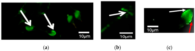 Effect of Sperm DNA Fragmentation and Chromatin Decondensation on PLCζ Efficacy in Infertile Patients.