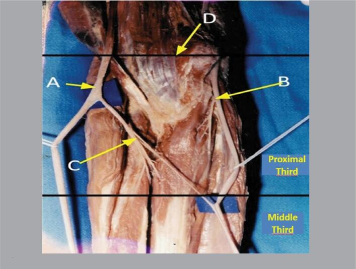 ANATOMOTOPOGRAPHIC STUDY OF THE MARTIN-GRUBER ANASTOMOSIS.